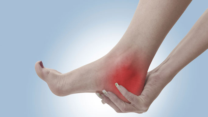 Oakland Chiropractic Treatment for Plantar Fasciitis